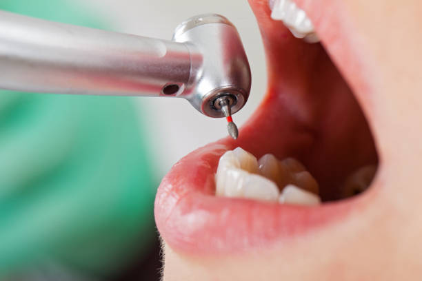 Best Emergency Denture Repair in Starkville, MS